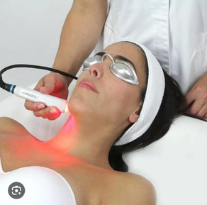 RADIOFRECUENCIA FACIAL 1 SESIÓN