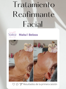 Tratamiento Reafirmante Facial