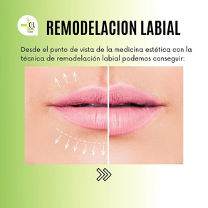 REMODELACIÓN LABIAL