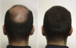 fibras capilares (Gris) 10 gr